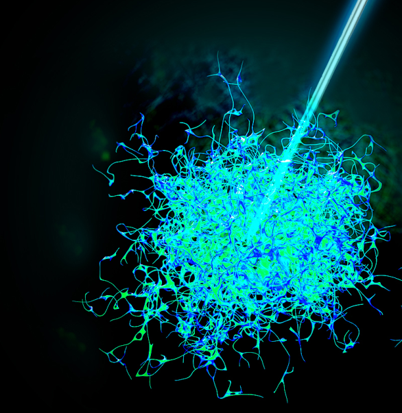 今天，我們把腫瘤的內(nèi)部「融穿」了