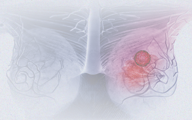 國際婦女節(jié) | 關(guān)注乳腺癌 微創(chuàng)介入讓美麗繼續(xù)，「乳」愿以償正成為現(xiàn)實
