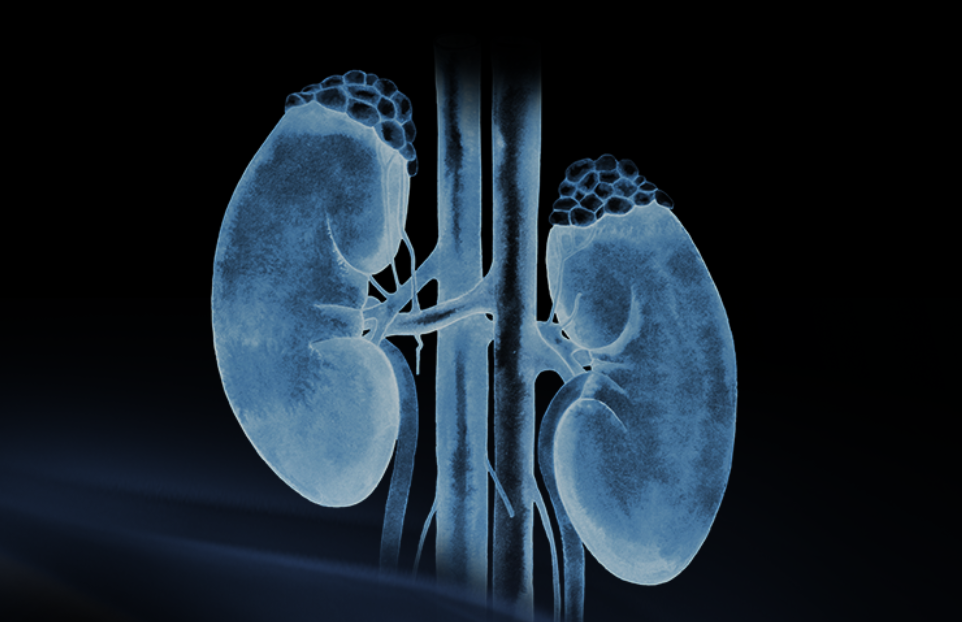 世界腎臟日 | 相得「腎」歡，融有術(shù)、精準(zhǔn)適形