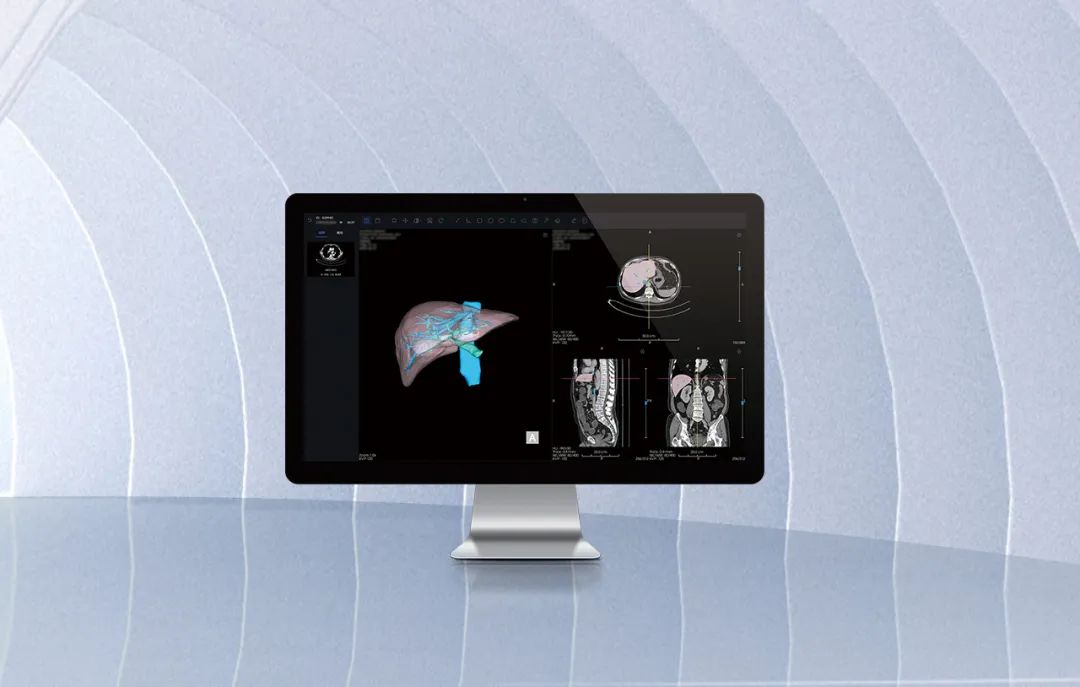 北京市首款！海杰亞醫(yī)療自主研發(fā)的AI+肝臟CT影像處理軟件獲批上市！